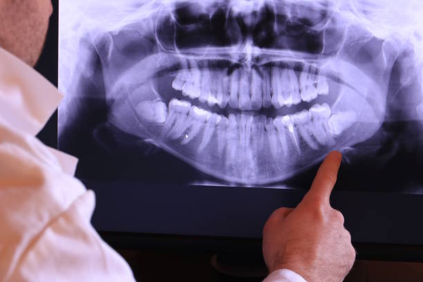 Trusted NJ Emergency Dental Service Experts